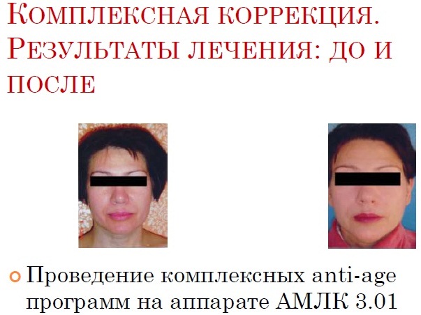 Аппарат лечебно-косметологический Галатея АМЛК 3.01